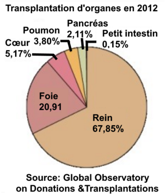 Transplantacija organa u 2012.