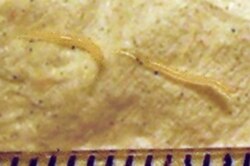 Enterobius vermicularis